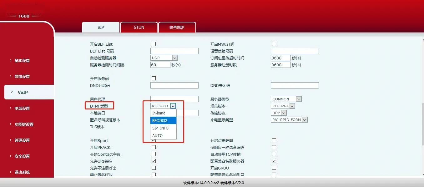 Interface des paramètres avancés SIP